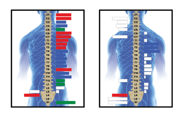 free stress scans illuminate chiropractic